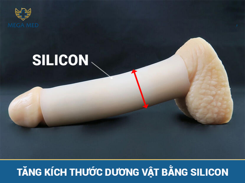 tăng kích thước cậu nhỏ phẫu thuật